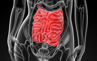 Leaky Gut -- 11 Different Causes and How it Can Wreck Your Life
