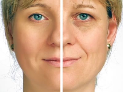 Microcurrent Facial Rejuvenation